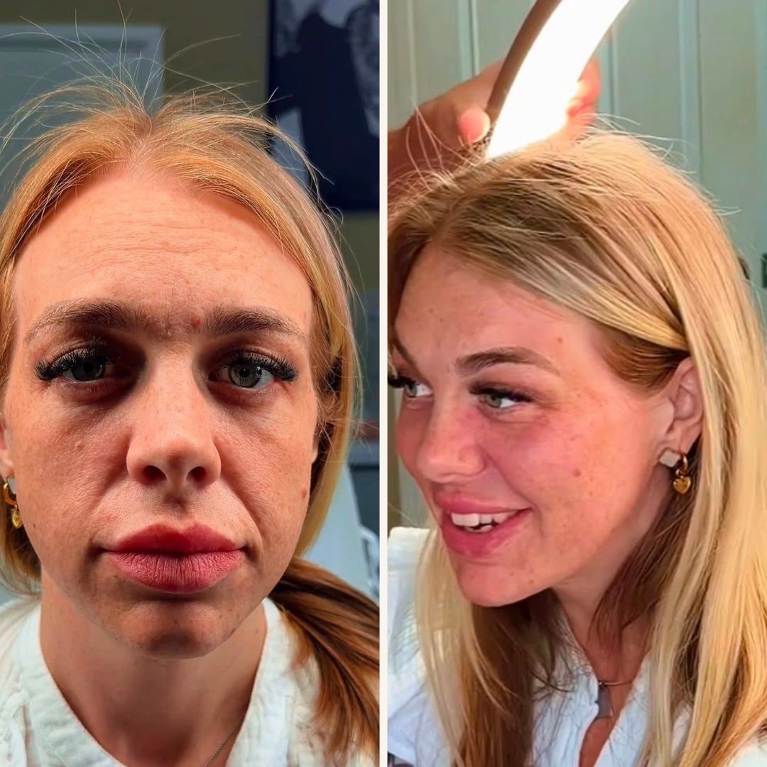 Before and after transformation