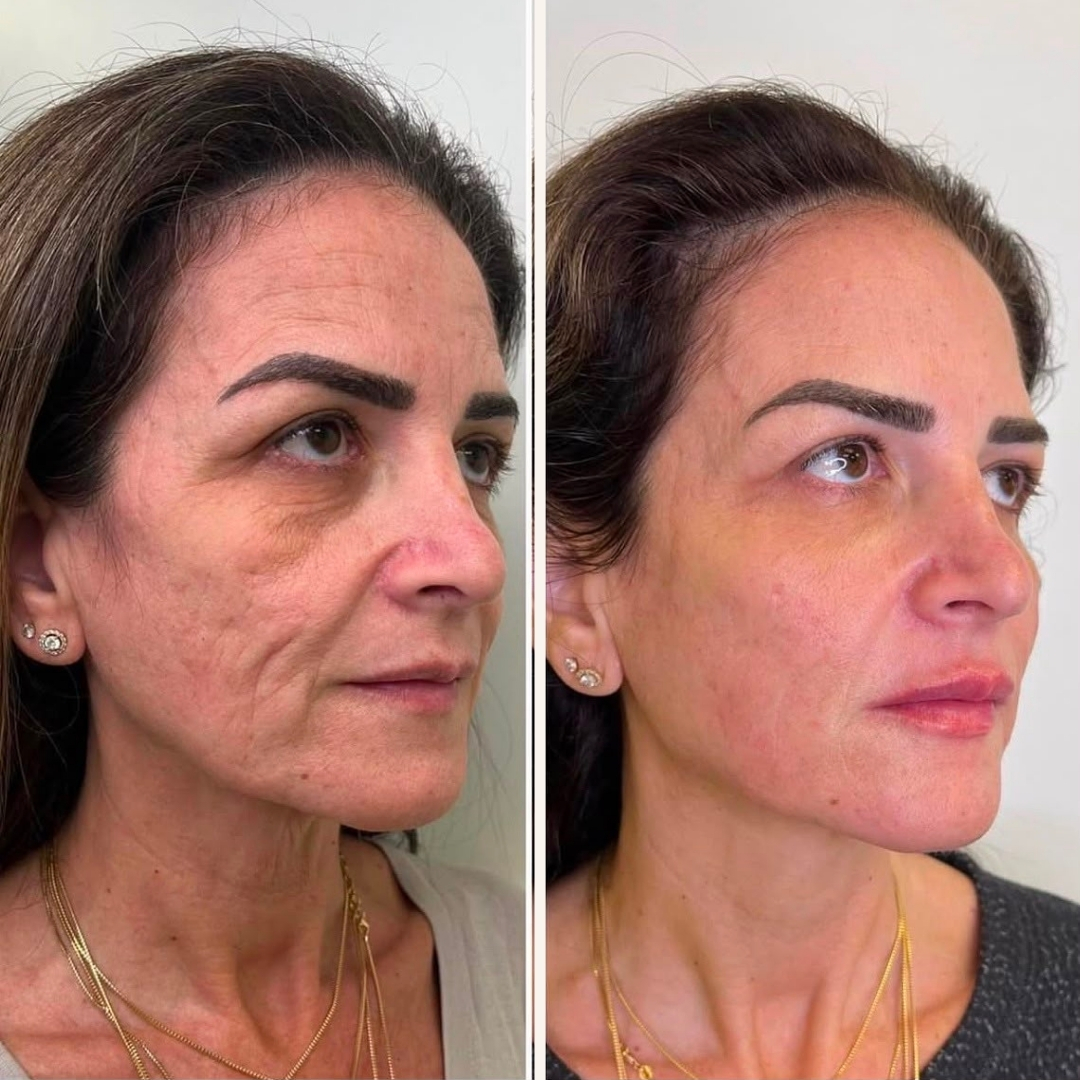 Before and after transformation