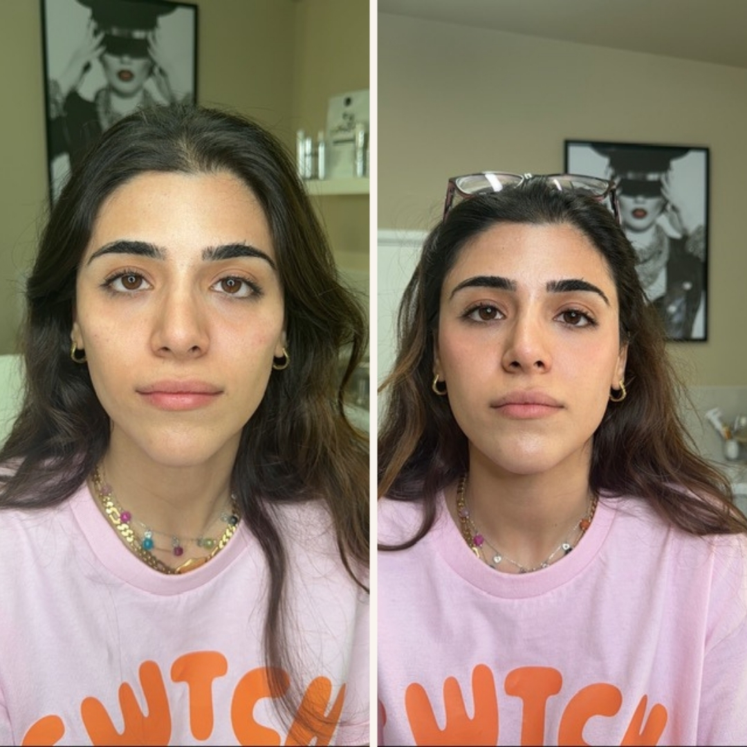 Before and after transformation