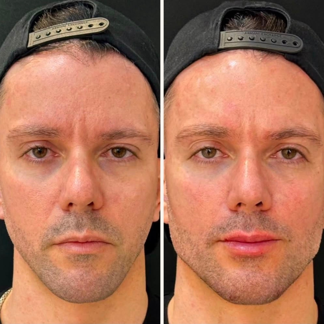 Before and after transformation