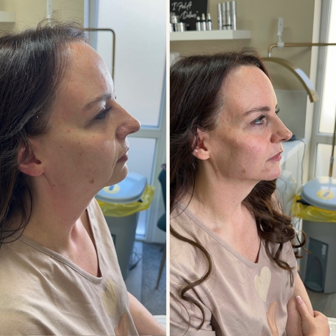 Before and after transformation