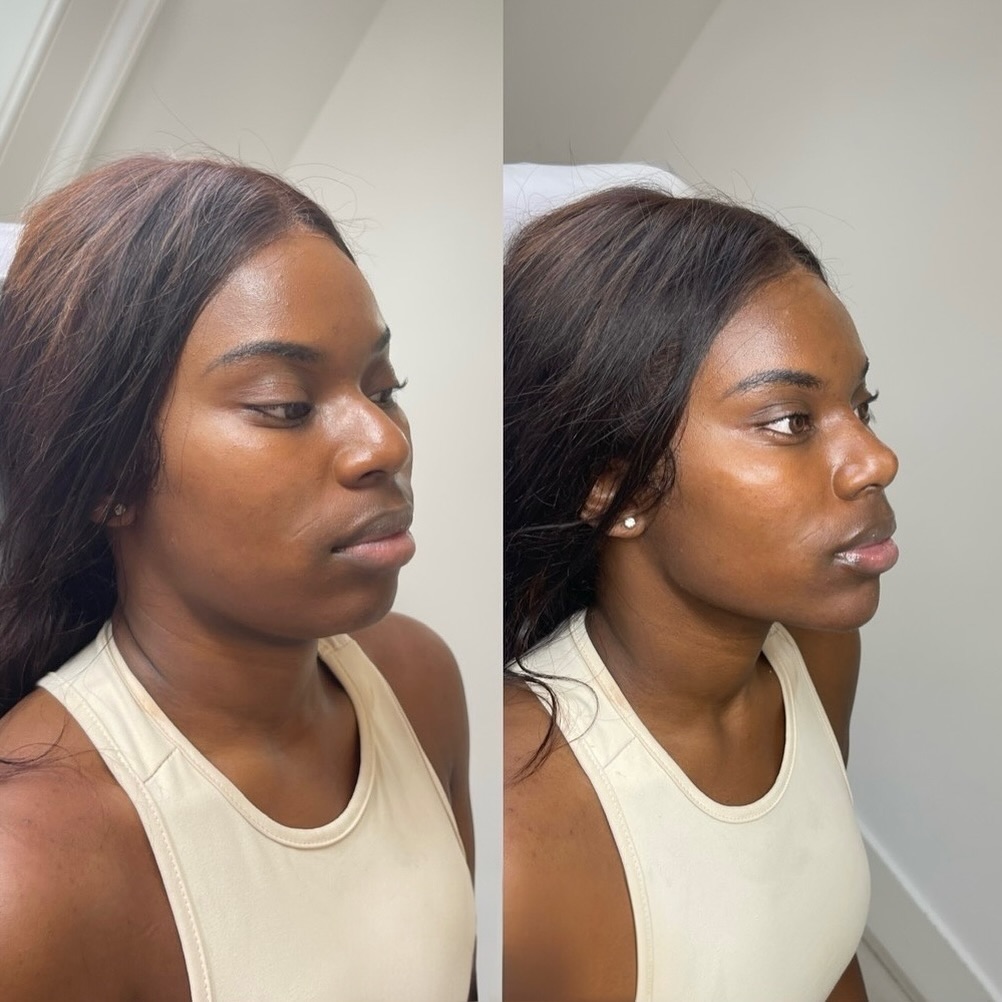 Before and after transformation